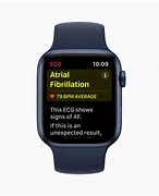 Image result for Apple Watch ECG Atrial Fibrillation