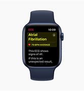 Image result for Apple Watch ECG App