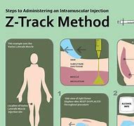 Image result for zcatalecto