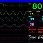 Image result for Normal Heart Rate Monitor