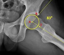 Image result for Lower Back and Groin Pain
