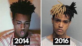 Image result for Baby Dreads Xxxtentacion