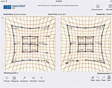 Image result for Hess Screen Chart
