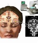 Image result for Brain Scan Memory