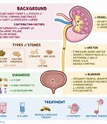 Image result for Urate Nephropathy