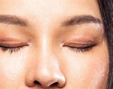 Image result for Double Eyelid Case