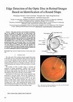 Image result for Optic Disc