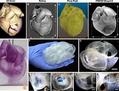 Image result for 3D Printed Human Heart