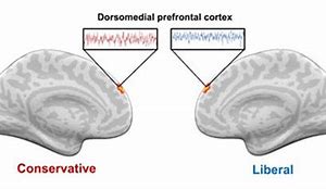 Image result for Partisan Brain Maps