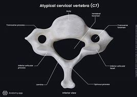 Image result for 4th and 5th Cervical Vertebrae