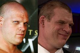 Image result for Kane Before and After