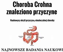 Image result for choroba_leśniowskiego_i_crohna