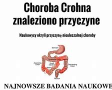 Image result for choroba_leśniowskiego crohna