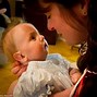 Image result for Trisomy 18 Syndrome Babies