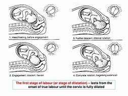 Image result for First Stage of Labour