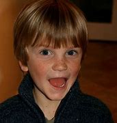 Image result for Boy Face Asperger