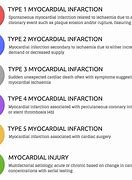 Image result for 5 Types of MI