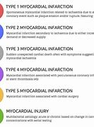 Image result for Infraction 6s vs 6s