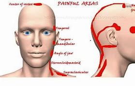 Image result for Carotid Battery