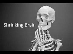Image result for Rapidly Shrinking Brain