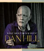 Image result for Dan Hill Look Like