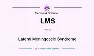 Image result for Lateral Meningocele