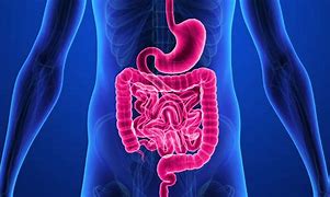 Image result for crohn
