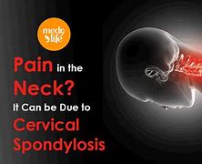 Image result for Cervical Spine Neck