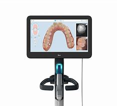 Image result for iTero Intraoral Scanner