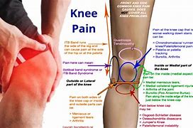 Image result for Sharp Pain On Right Knee