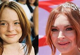Image result for Lindsay Lohan Before Surgery