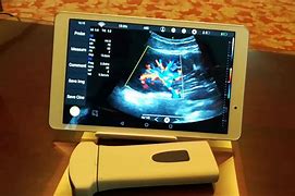 Image result for RF Scanner with iPhone