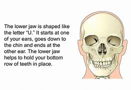 Image result for Jawbone Deterioration