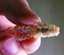 Image result for Human Mouth Parasites