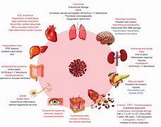 Image result for Long Covid Repeat Infection