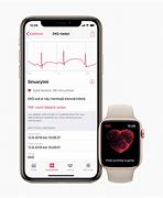 Image result for Apple Watch 5 EKG