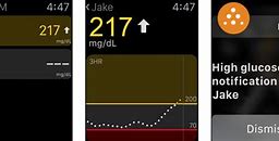 Image result for Apple Watch Blood Glucose Monitor