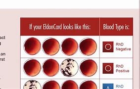 Image result for How to Check Blood Type