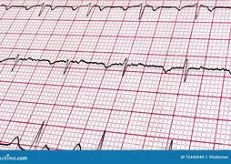 Image result for cardiogramq