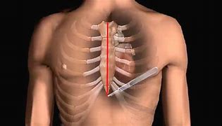 Image result for Open Heart Surgery Procedure