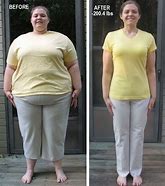 Image result for 200 Lb Weight Loss Before and After