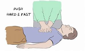 Image result for CPR Animated Images