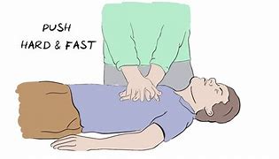 Image result for CPR Cartoon Picture