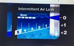 Image result for Atrium Chest Tube Air Leak