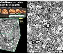 Image result for Oldest Person Cryopreserved