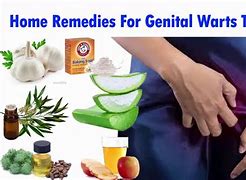 Image result for genital warts treatments