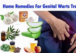 Image result for genital wart home remedy