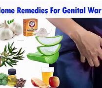 Image result for How to Treat Gential Wart