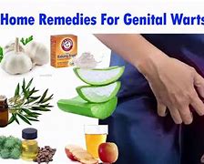 Image result for Treatment for Genital Warts