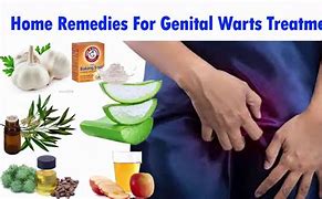 Image result for Treatment of Genital Warts